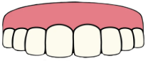 Machoir Supérieure